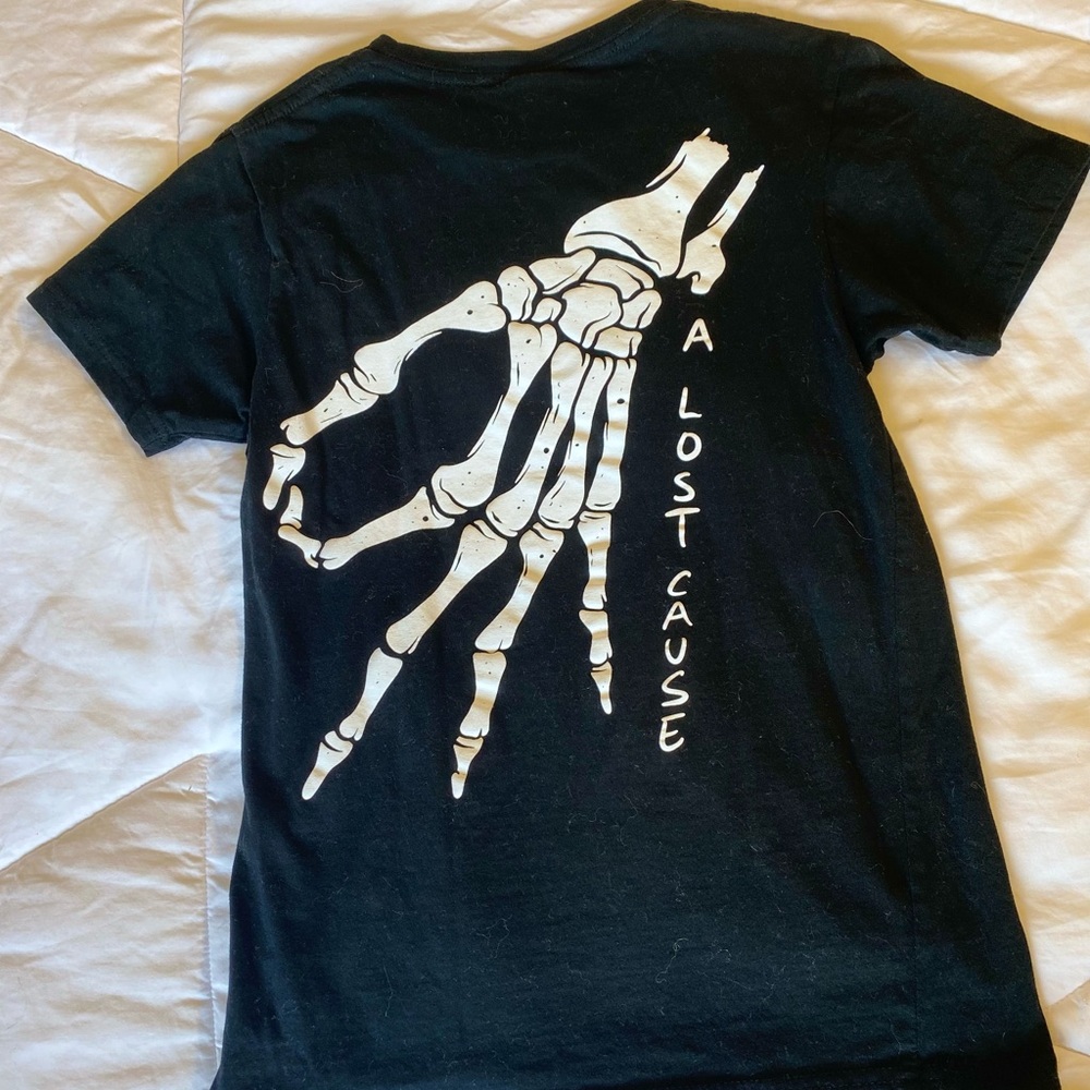 ALC Graphic Skeleton Tee